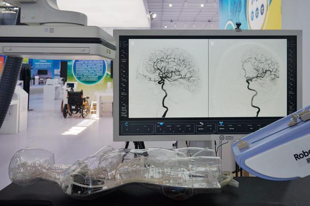 高精度微创血管介入手术机器人。新京报记者 郑新洽 摄