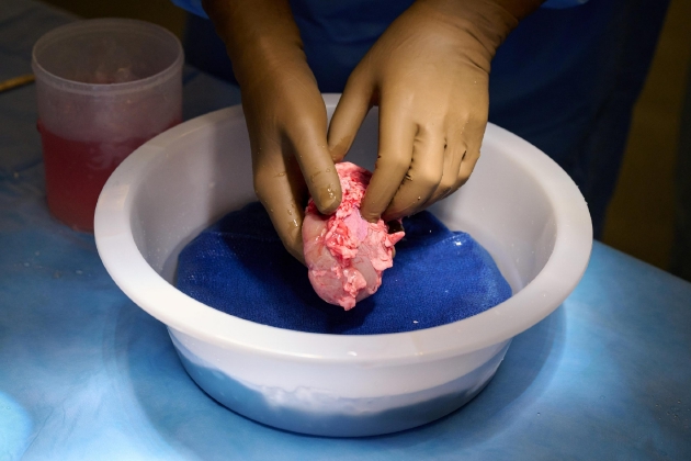 研究人员正在清洗一个基因工程猪肾，准备将其移植给人类。