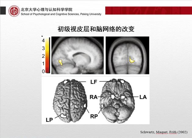 成人大脑还有多大可塑性