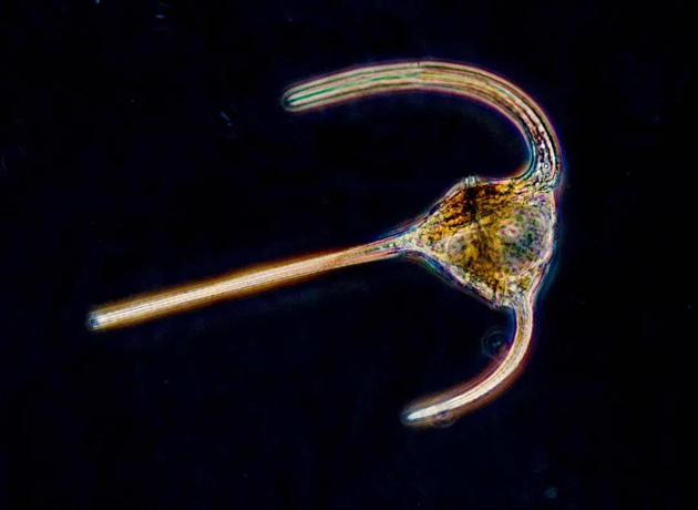 某种甲藻的显微照片