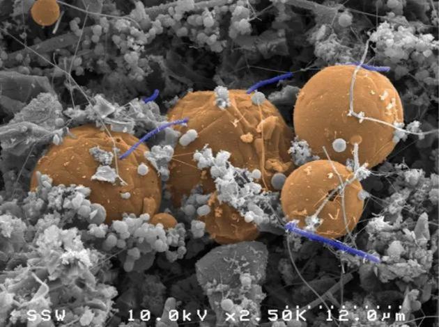 Candidatus Desulforudis audaxviator 是一种蓝色杆状细胞，它们遍布在橙色碳球之间，是一种依靠氢生存的细菌，科学家发现它们生活在地下2.8公里深处。