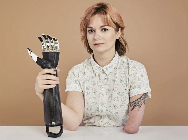 原作者 britt young 与她的 ottobock ilimb 仿生手臂|gabriela