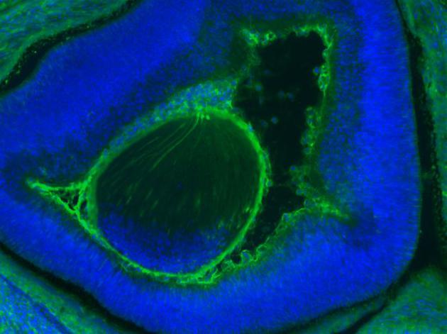 小鼠胚胎眼睛（蓝色）中形成的人类细胞（绿色）