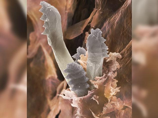 脸部螨虫会钻进毛囊底部的毛穴里。这张扫描电子显微镜图像显示了螨虫从毛囊中钻出的情景。