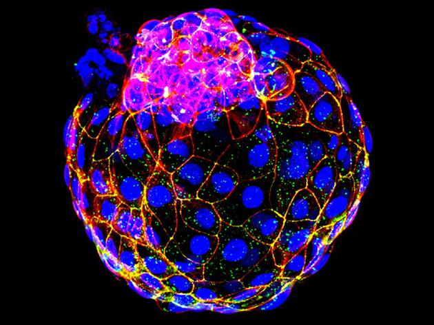 多支研究团队利用人类干细胞培育出了如图所示的类人囊胚
