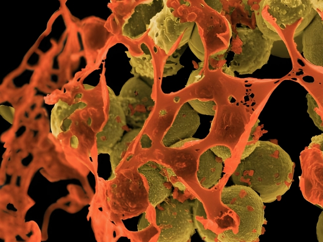 图为在扫描电子显微镜下、被细胞碎片包围的耐甲氧西林金黄色葡萄球菌（简称MRSA），该细菌对多种常见抗生素都有耐药性。