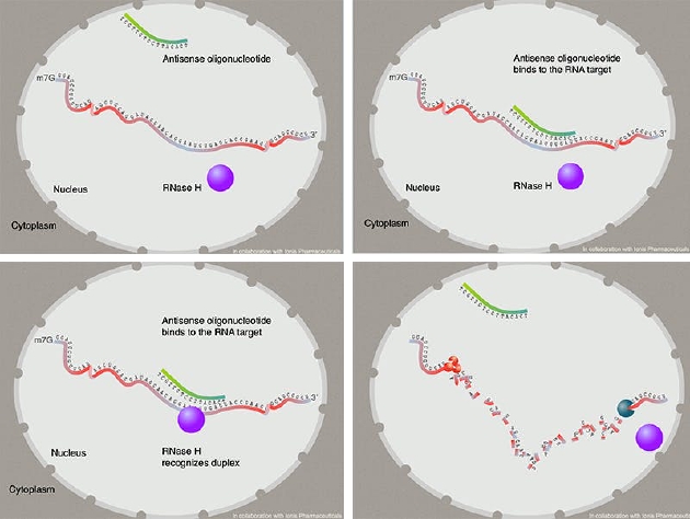 预备，瞄准，一击即中：反义寡核苷酸与MALAT1 RNA上的特定区域结合，类似于魔术贴带的粘合方式。紧接着，一组酶将会过来将MALAT1 RNA分解。