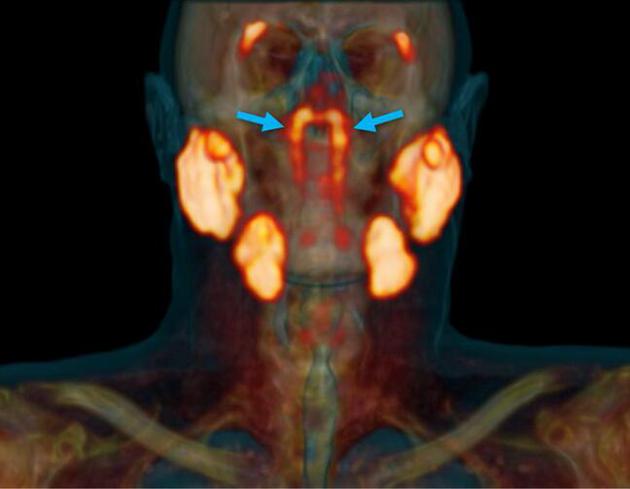 根据这组腺体所处的位置，研究人员将其命名为“咽鼓管腺”（tubarial glands），因为腺体十分靠近咽鼓管圆枕（torus tubarius）