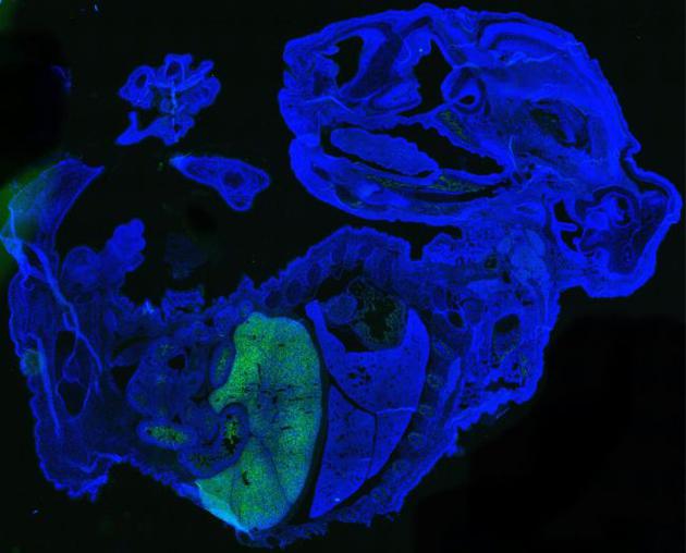 这是一个小鼠-人类嵌合体，显示了17天大的小鼠胚胎（蓝色）中的人类细胞（绿色），这些细胞主要是在小鼠肝脏中积累的红细胞