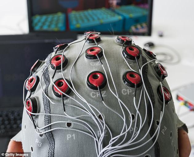 科学家表示，将人类大脑直接连接至计算机可能并不像你想象的那样遥远。图中是瑞士洛桑联邦理工学院（EPFL）最新研制的脑机接口设备。