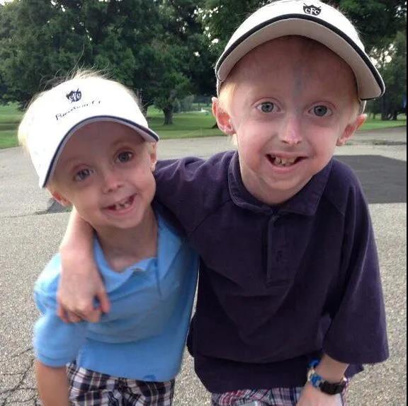 为什么会早衰？