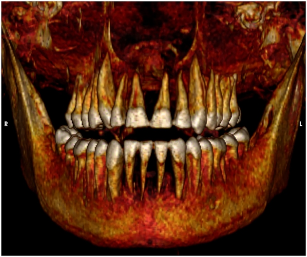 阿蒙霍特普一世牙齿状况良好。