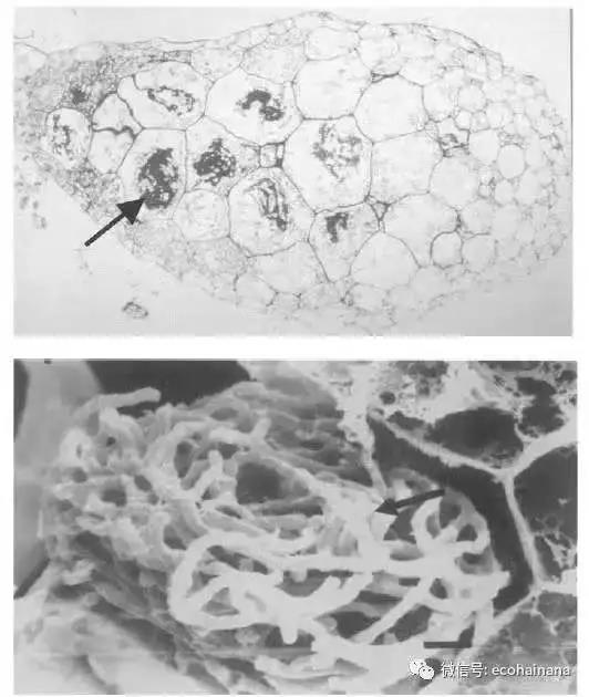 图7 小斑叶兰球茎（上）箭头所示为细胞内共生的菌丝；扫描电镜下的细胞内菌丝（下）（图片来自网络）