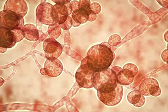复旦大学科研团队报道一种新“超级真菌”引起的暴发性感染