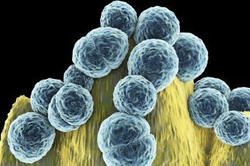 耐甲氧西林金黄色葡萄球菌（MRSA）可导致脆弱人群的伤口感染、肺炎和血液中毒