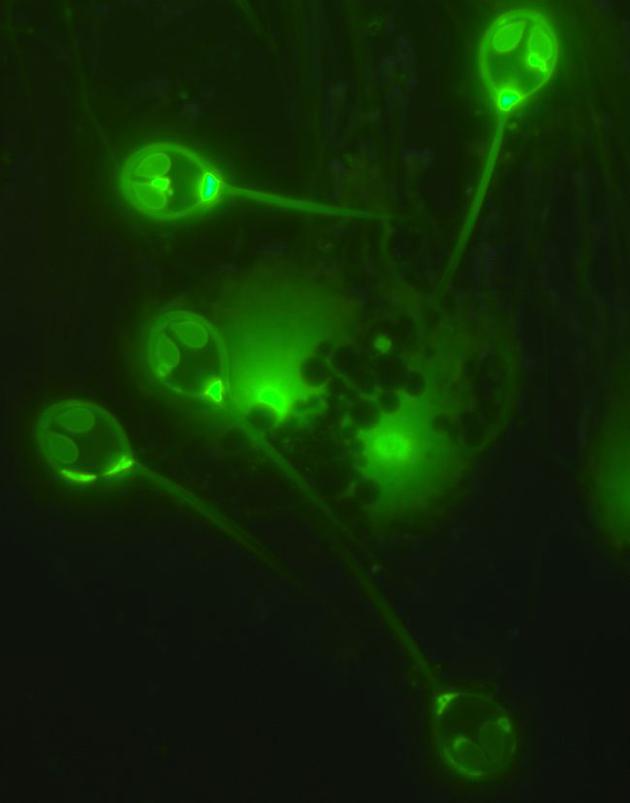 2、在荧光显微镜下，鲑生粘孢虫呈现出亮绿色，它们不需要呼吸就能寄生在鲑鱼体内，并且没有线粒体基因组。