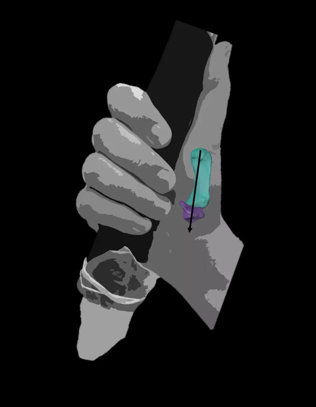 一个现代人展示的“力性抓握”，尼安德特人在抓握人造工具时可能就是以这种方式。这样抓握时，需用拇指的指向力将工具握在手指和手掌间。图片来自Ameline Bardo。