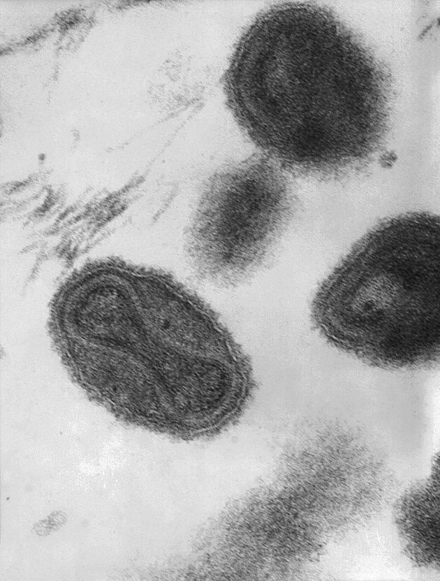 穿透式电子显微镜下的天花病毒。病毒粒子的中央位置呈哑铃状，内含病毒的脱氧核糖核酸（或称DNA）。