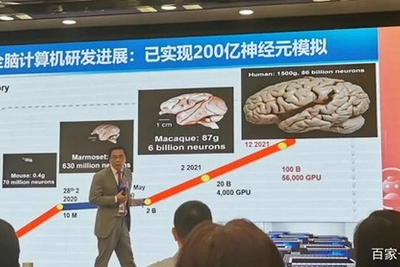 计算机明年接近人脑 失明、失聪、瘫痪不再是障碍？