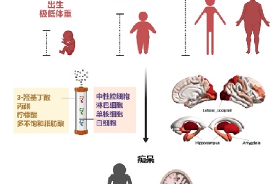 新研究表明体重失控将增加痴呆风险