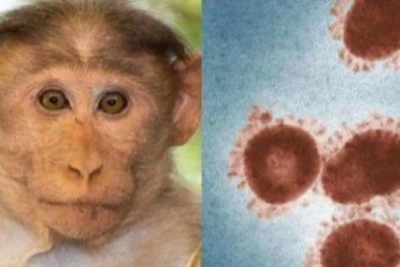 基因测序证实猴痘已大规模社区传播 国卫生官员为6月拉响警报
