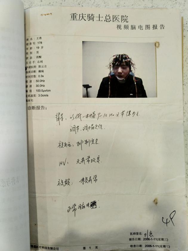 王勇在骑士医院的脑电波报告.