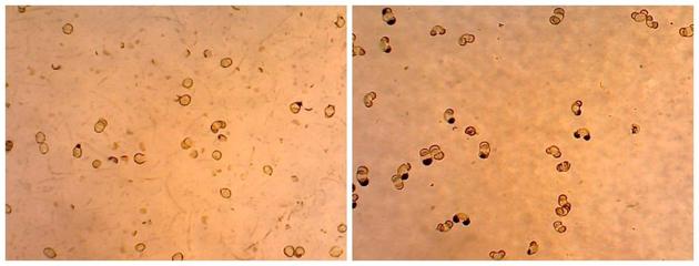 以其中1款破壁机和1款搅拌机分别搅打过的松花粉在显微镜下的照片为例