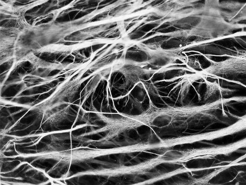 来源于干细胞的神经元 图片来源：Silvia Riccardi/SPL