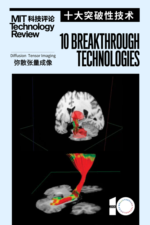 “DTI 让我们能够以前所未有的方式检视大脑。”