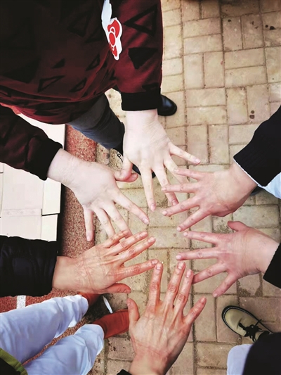 医护人员的手勒痕明显记者