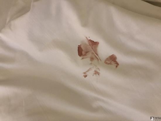 网友投诉汉庭酒店入住汉庭酒店刚要休息发现被子反面有大片血迹