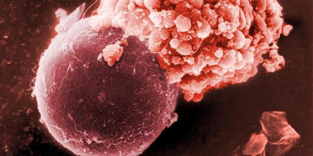 地球上最大和最小性细胞:小得难以置信 大得令人惊奇