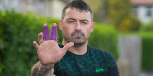 英国一男子用iPhone 7接电话时手机爆炸 手掌受伤