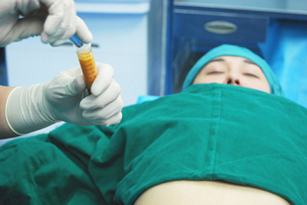 隆胸妈妈给宝宝喂奶后左胸膨胀似篮球