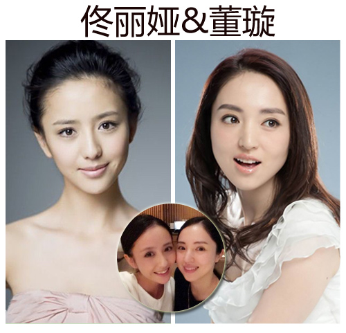 佟丽娅&董璇明星闺蜜:佟丽娅&董璇要是说到明星撞脸,相信大家首先想到
