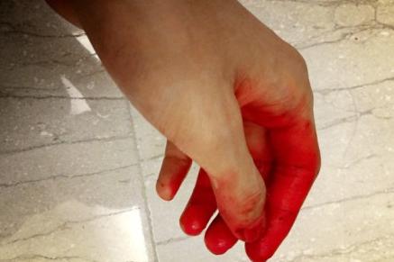 许嵩手染红似沾血 粉丝调侃:秋裤掉色?