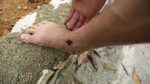 阿sa丛林遭遇蚂蝗吸血 大喊"太恶心"