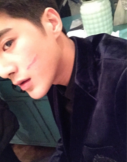 姜潮晒受伤照自黑这次不给我妈打电话了