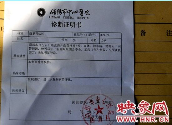 信阳浉河区一女教师长期殴打学生 致10岁男童面瘫