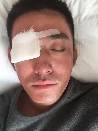 张博《巨浪》眼部受伤 轻伤不下火线