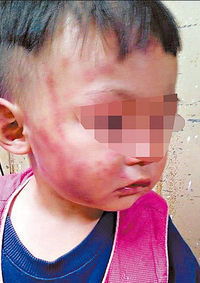 虐童男庙前自扇135个巴掌忏悔