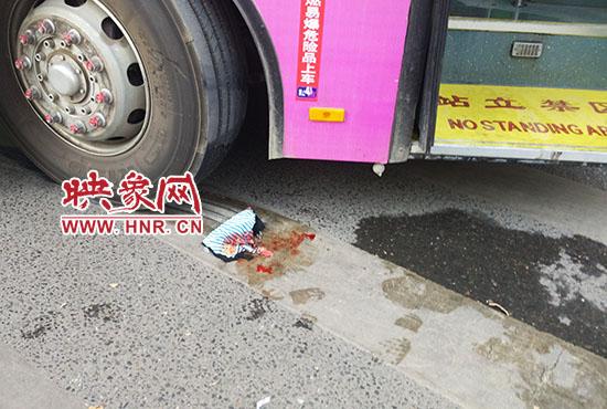 郑州女子被公交轧断腿路人衣服上都是肉酱