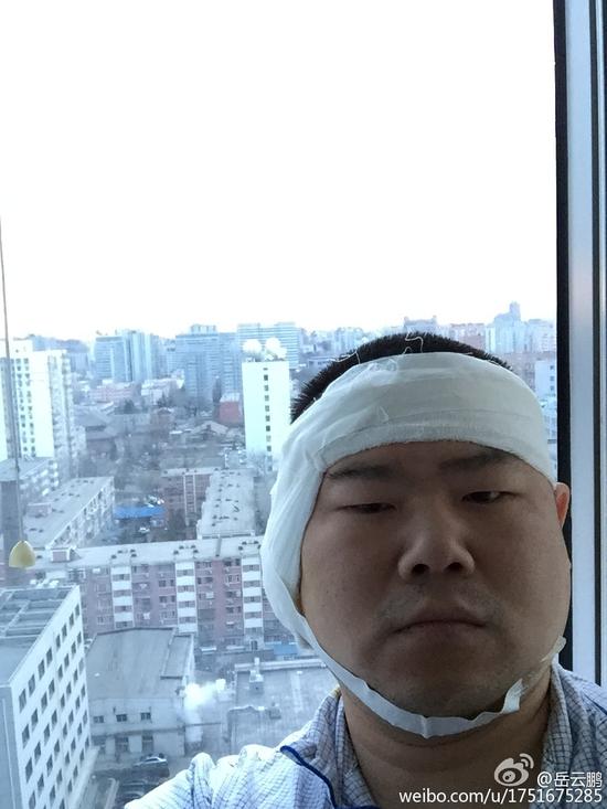 27日早晨,德云社相声演员岳云鹏[微博]在微博晒出自己脸包纱布的照片
