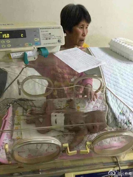 高位肛门闭锁能治好吗 宝宝肛门闭锁能买上商业险吗