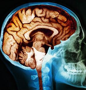 富家子女脑容量大?比穷孩子高44%