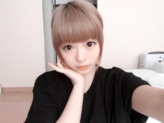 卡莉怪妞自曝喝醉酒浴室滑到撞破头缝7针