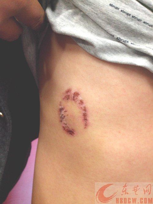 番茄酱弄洒引发争执肯德基员工咬伤顾客图