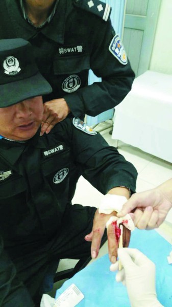 男子割腕自杀刚被救下抡起菜刀砍伤警察