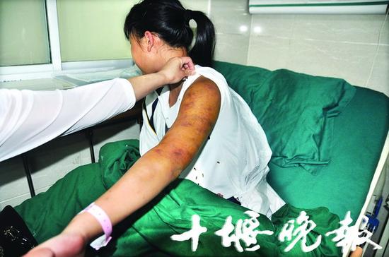 十堰女生因小事寝室内遭3女同学围殴 全身多处损伤