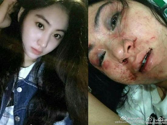 美女歌手拒陪酒遭老板娘毒打3小时 伤痕累累